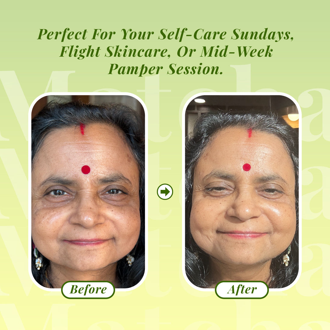 Sunny Herbals Matcha Miracle Sheet Mask