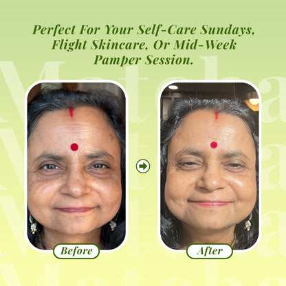 Sunny Herbals Matcha Miracle Sheet Mask